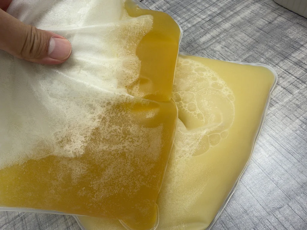 Two plasma collection bags after a session: one deeper amber and clearer, the other paler, cloudier and foamy
