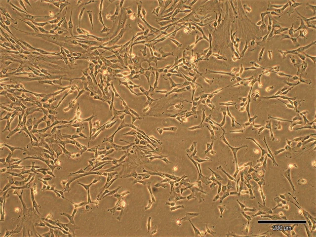 Umbilical-cord mesenchymal stem cells in culture under a microscope